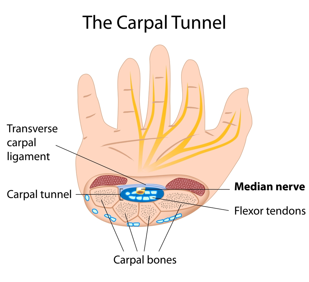 http://www.advancedhealthcareofthepalmbeaches.com/carpal-tunnel-syndrome/